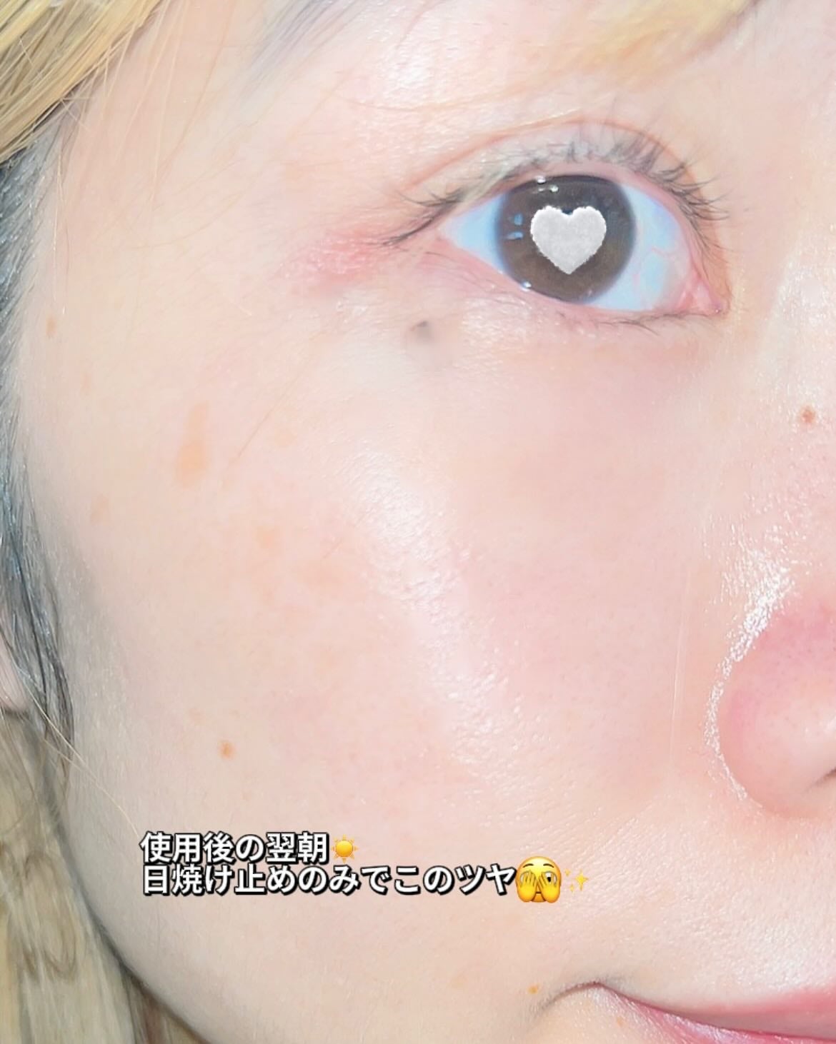 PDRNショット675/COSNORI/美容液を使ったクチコミ(4枚目)