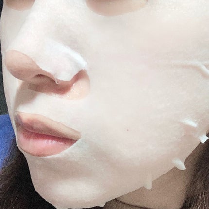 ルルルン ハイドラ V マスク/ルルルン/シートマスク・パックを使ったクチコミ(4枚目)