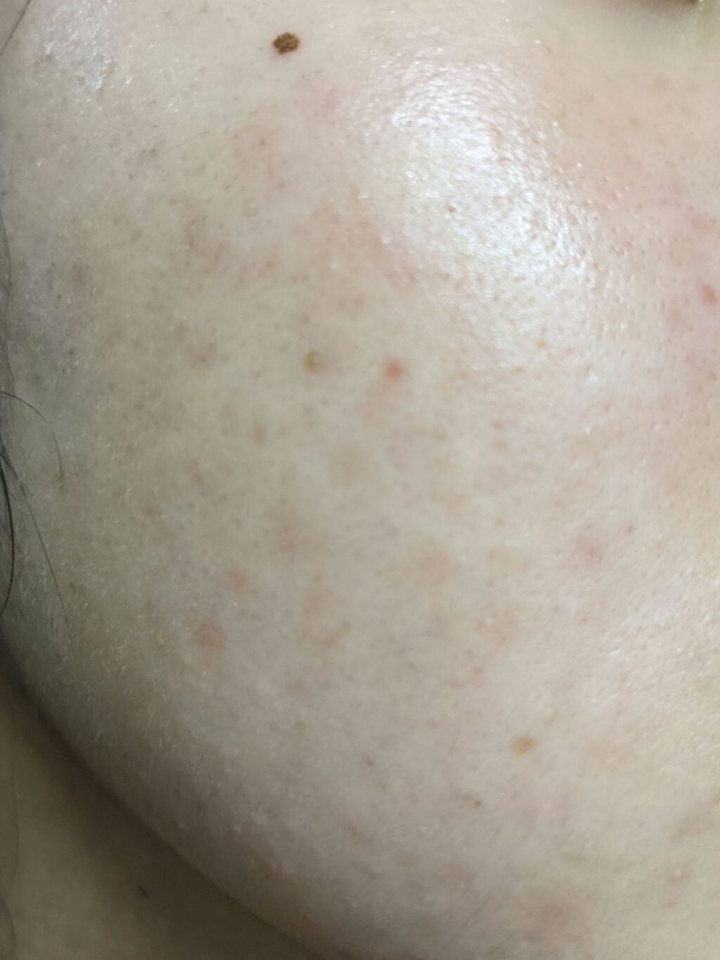 DHC はとむぎエキス/DHC/健康サプリメントを使ったクチコミ(7枚目)