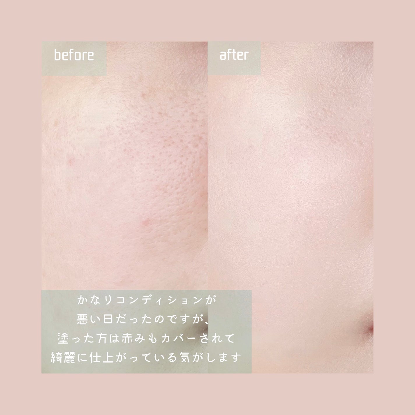 ティーツリーデイデイトーンアップサンクッション/NOWATER/日焼け止めローションを使ったクチコミ(4枚目)