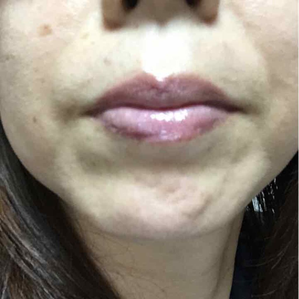 【旧】ディオール アディクト リップ マキシマイザー/Dior/リップグロスを使ったクチコミ（2枚目）