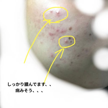 ロゼット 洗顔パスタ 白泥リフト/ロゼット/洗顔フォームを使ったクチコミ(3枚目)