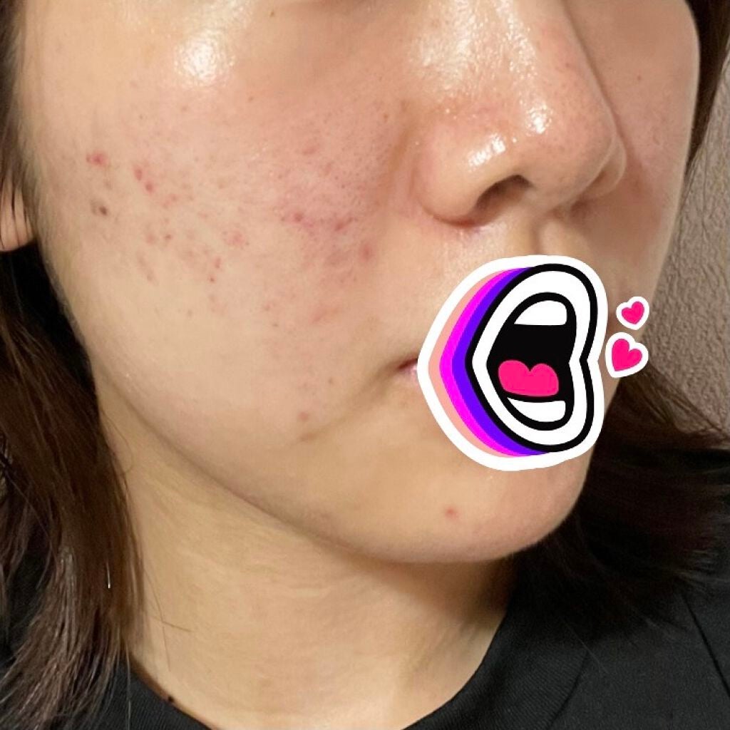 たべっこ on LIPS 「8/24(火)☁️夜やっぱビタミンCのパックいいんかも!気持ち..」(3枚目)