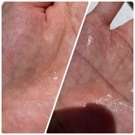 センテラ アンプル/SKIN1004/美容液を使ったクチコミ(3枚目)