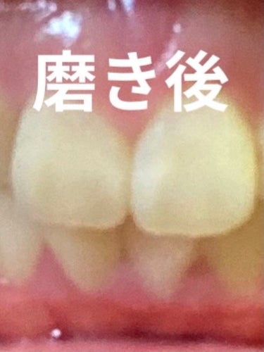 歯を白くするsu・po・n・ji/ミュー/その他オーラルケアを使ったクチコミ（3枚目）