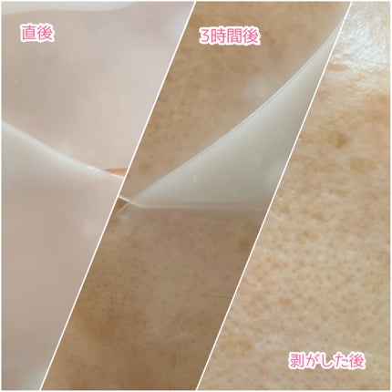 ハイドロセラノールリアルディープマスク/Biodance/シートマスク・パックを使ったクチコミ(5枚目)