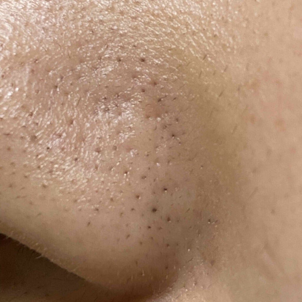 ハトムギ化粧水(ナチュリエ スキンコンディショナー R )/ナチュリエ/化粧水を使ったクチコミ(4枚目)