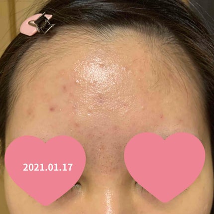 モイスチャージェル2/エンビロン/フェイスクリームを使ったクチコミ(4枚目)