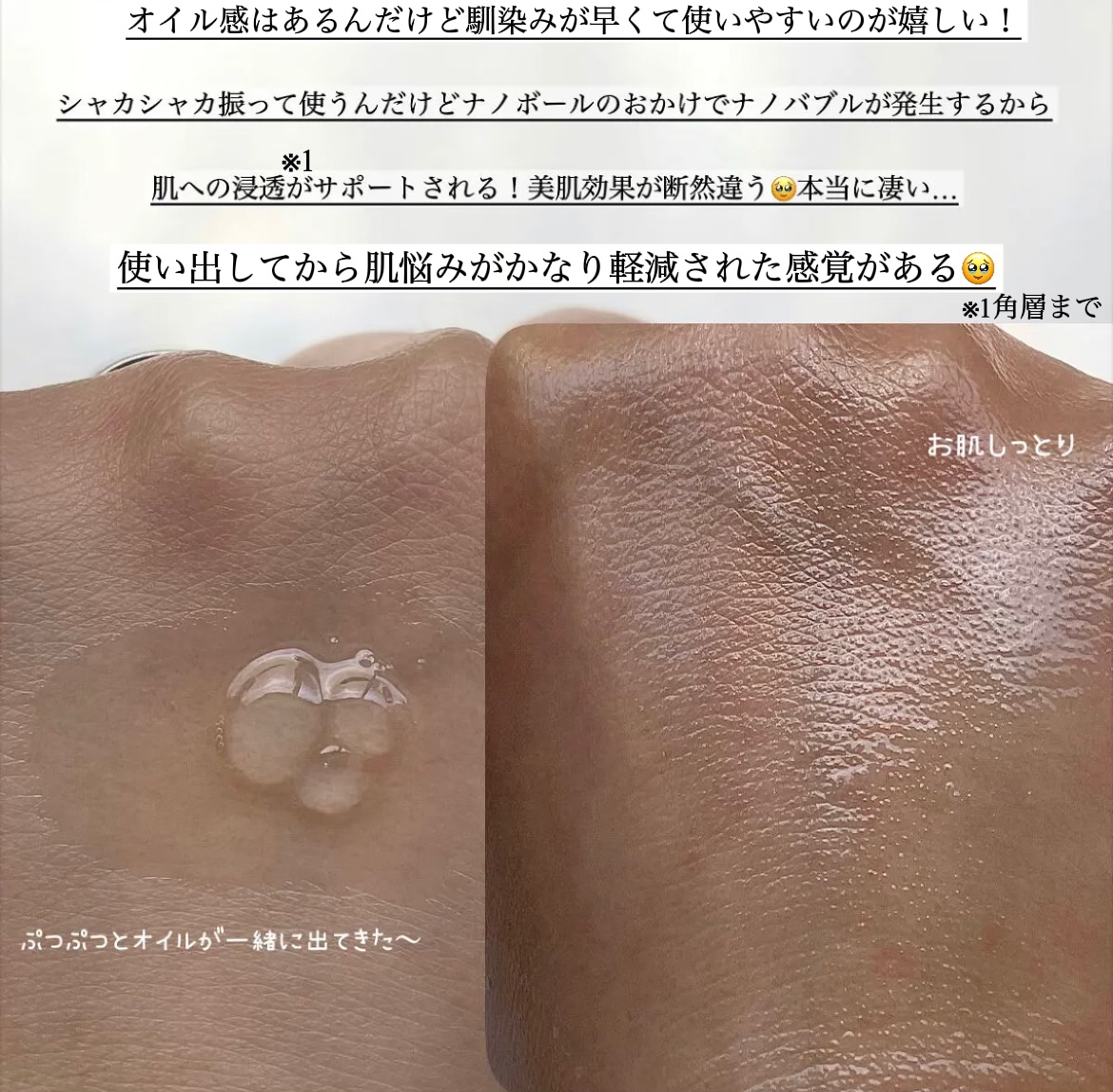 バブバブ ナノバブルオイルローション/Bab2/化粧水を使ったクチコミ（3枚目）