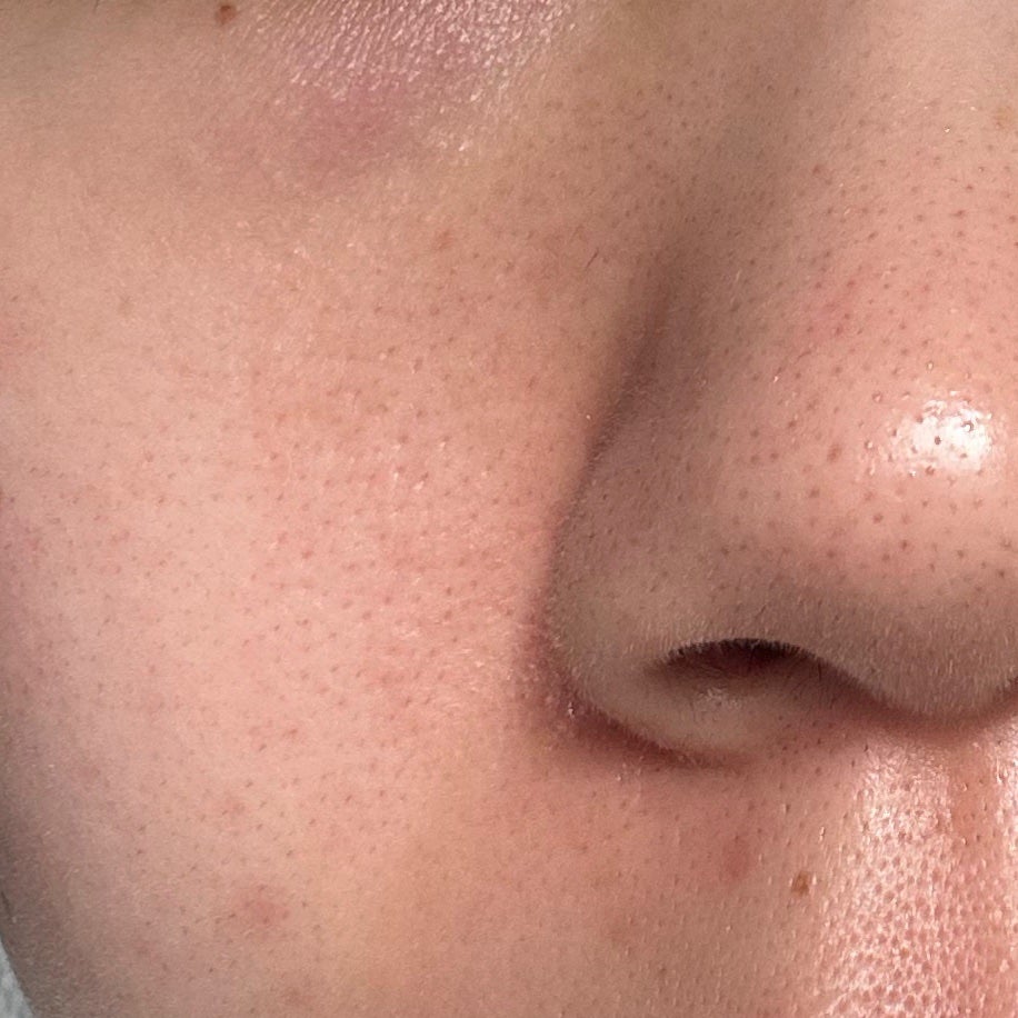 リードルショット100/VT/美容液を使ったクチコミ(7枚目)