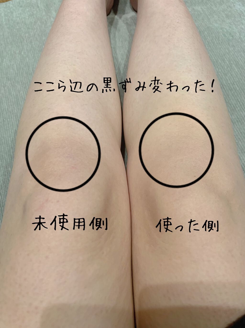 薬用ホワイトコンク ボディシャンプーC II/ホワイトコンク/ボディソープを使ったクチコミ(8枚目)