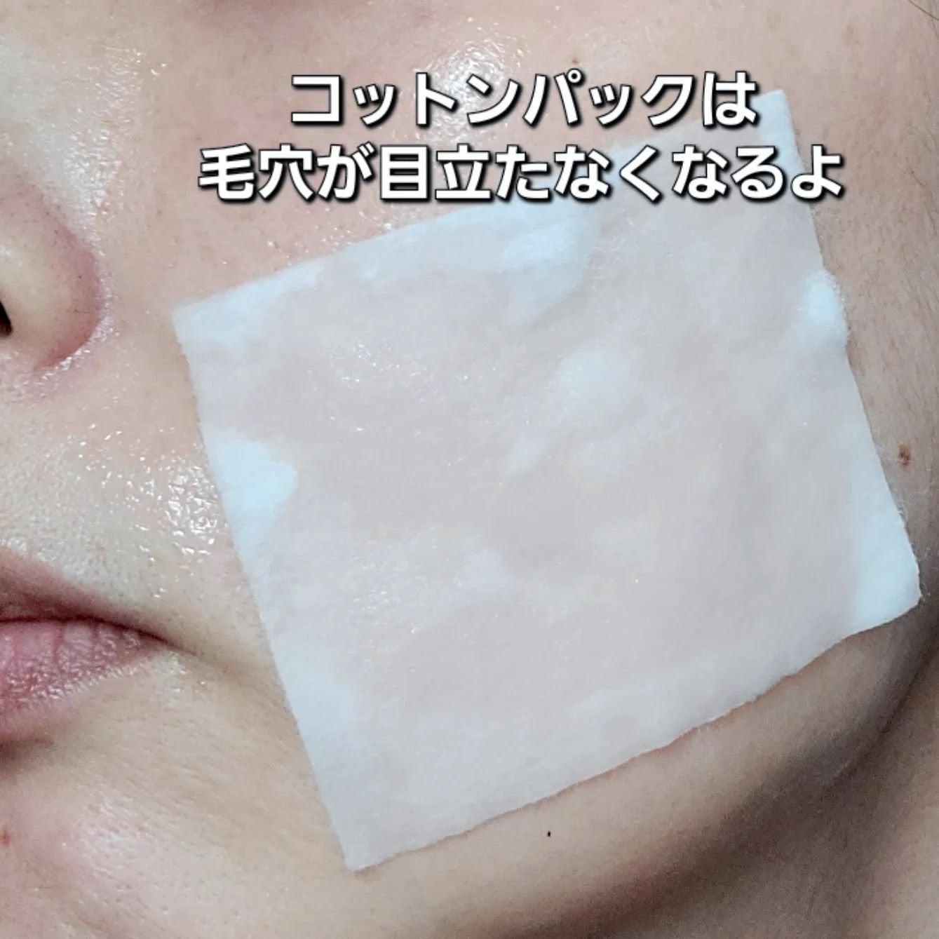 ホームピールコンセントレート/HERBAL PEEL/化粧水を使ったクチコミ(5枚目)