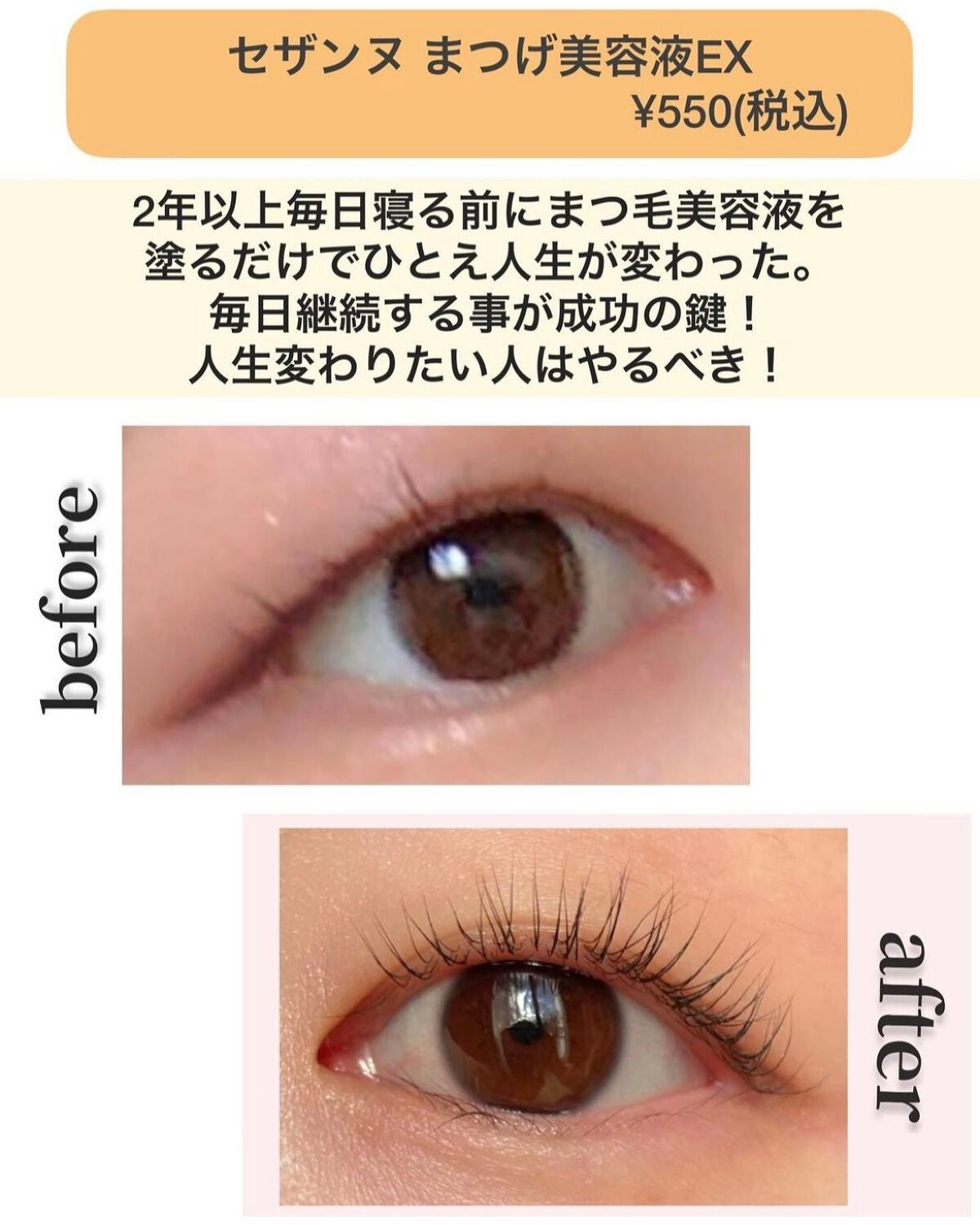 ひとえ・奥ぶたえ用カーラー/アイプチ®/ビューラーを使ったクチコミ(3枚目)