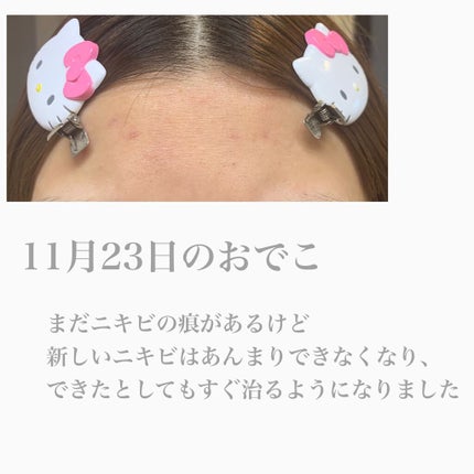 極潤ヒアルロン乳液/肌ラボ/乳液を使ったクチコミ(3枚目)