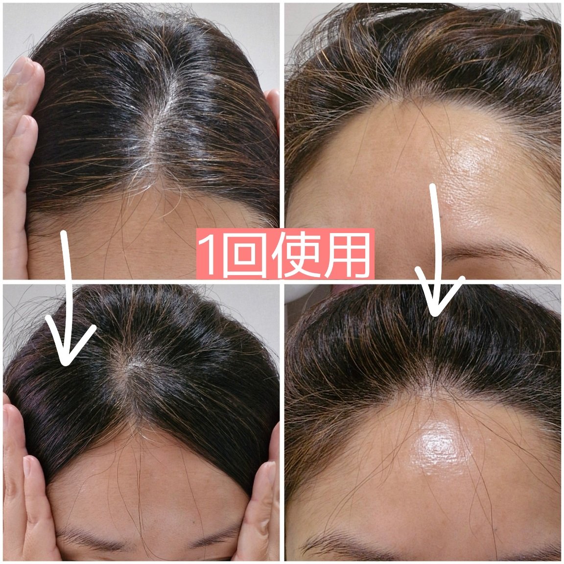 カラートリートメント/サイオス/ヘアカラーを使ったクチコミ（2枚目）