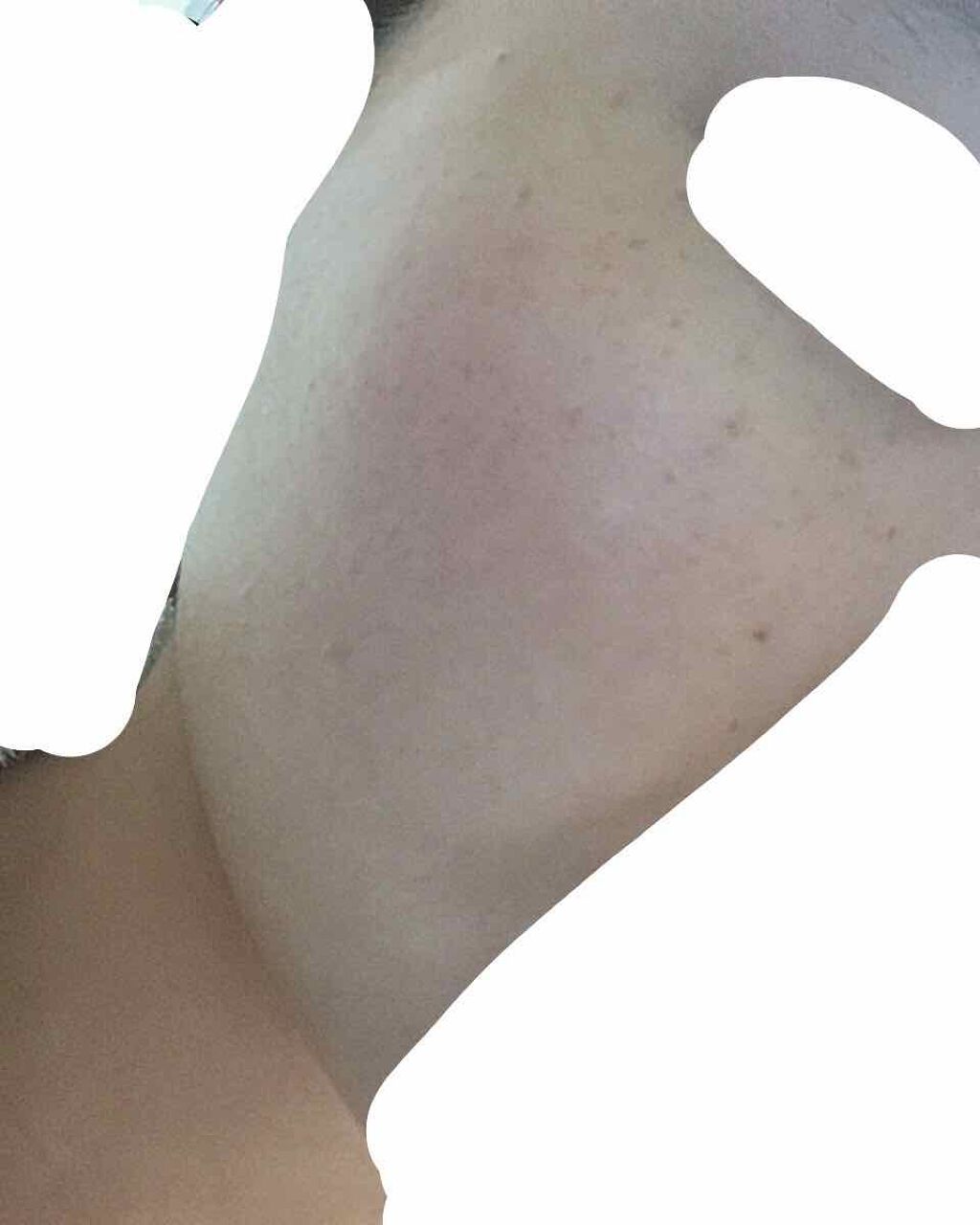 グリーンタンジェリン ビタC ダークスポットケアセラム/goodal/美容液を使ったクチコミ(4枚目)