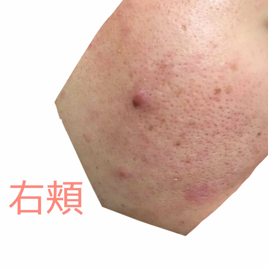 明色美顔水 薬用化粧水/美顔/化粧水を使ったクチコミ（2枚目）