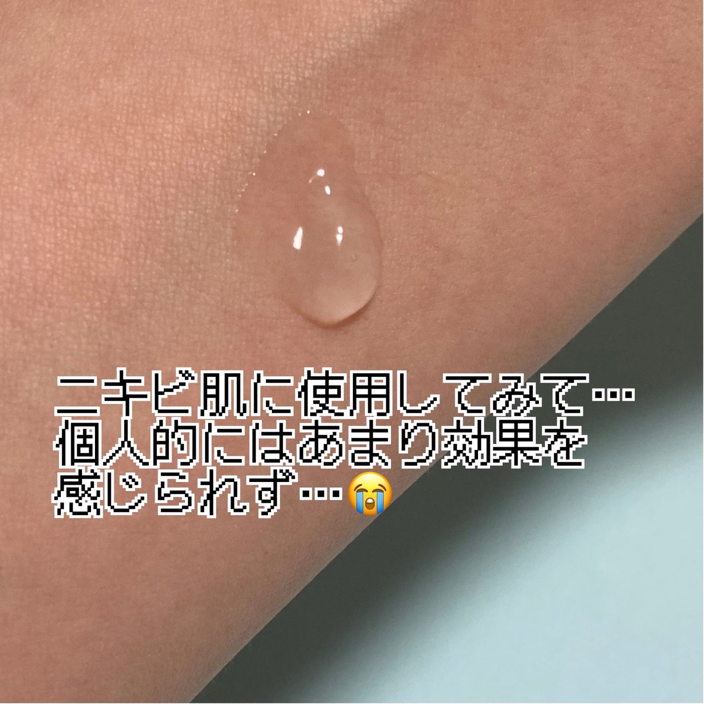 アクニドクターファーストスピーディースポット/ISOI/美容液を使ったクチコミ(3枚目)