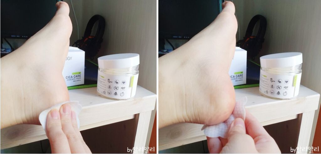 CICACARE ESSENCE PADS/VEGAN TOLOGY/化粧水を使ったクチコミ（2枚目）