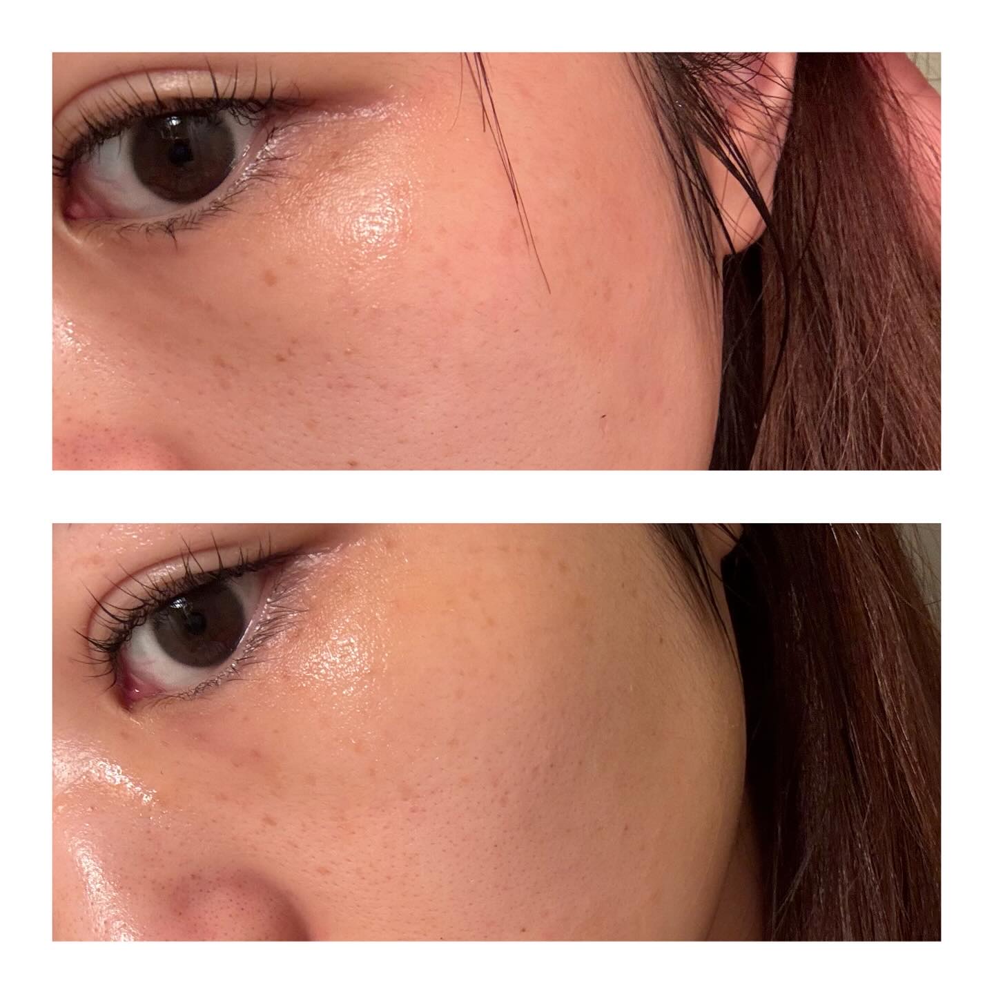 パンテショット675/COSNORI/美容液を使ったクチコミ（3枚目）