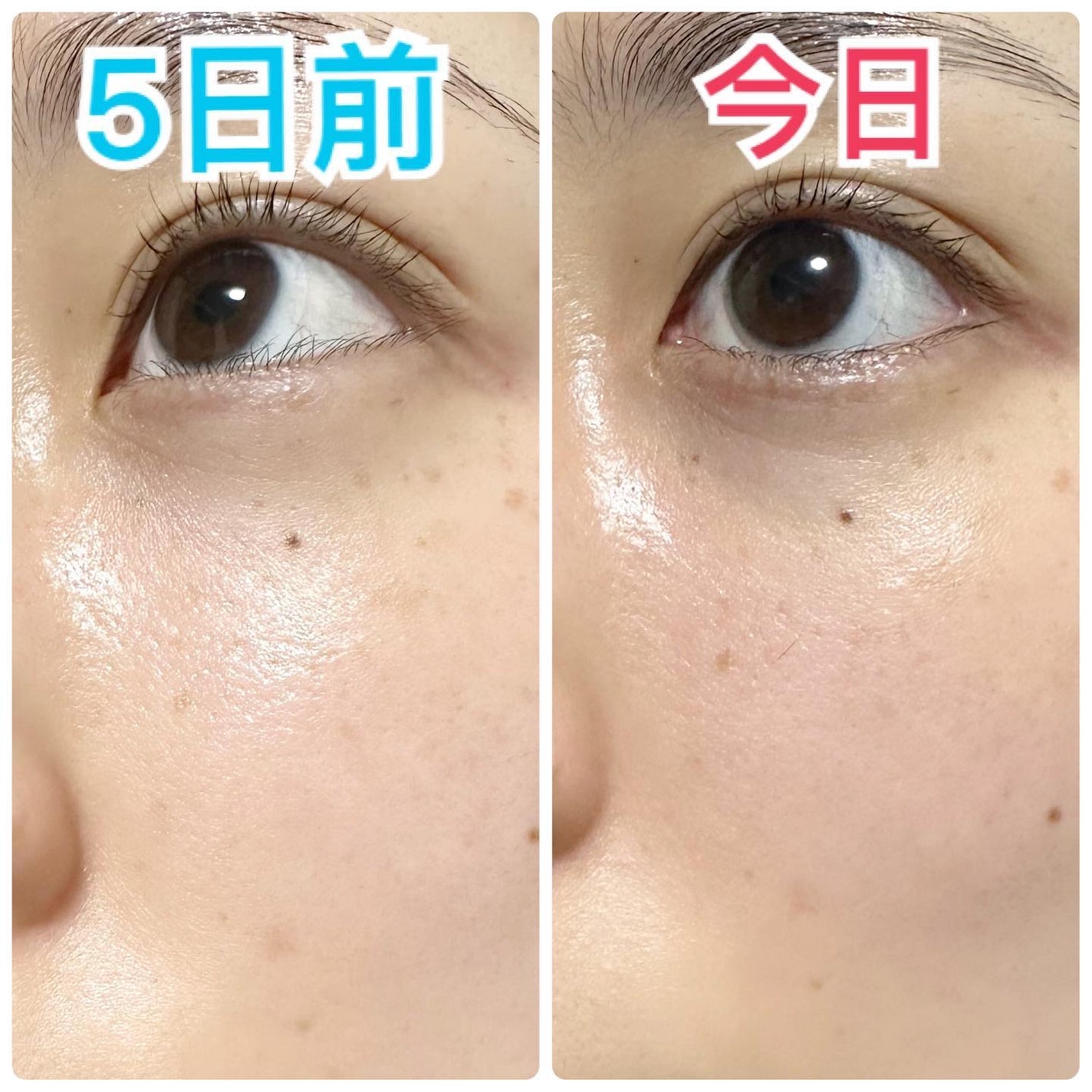 リードルショット100/VT/美容液を使ったクチコミ(8枚目)