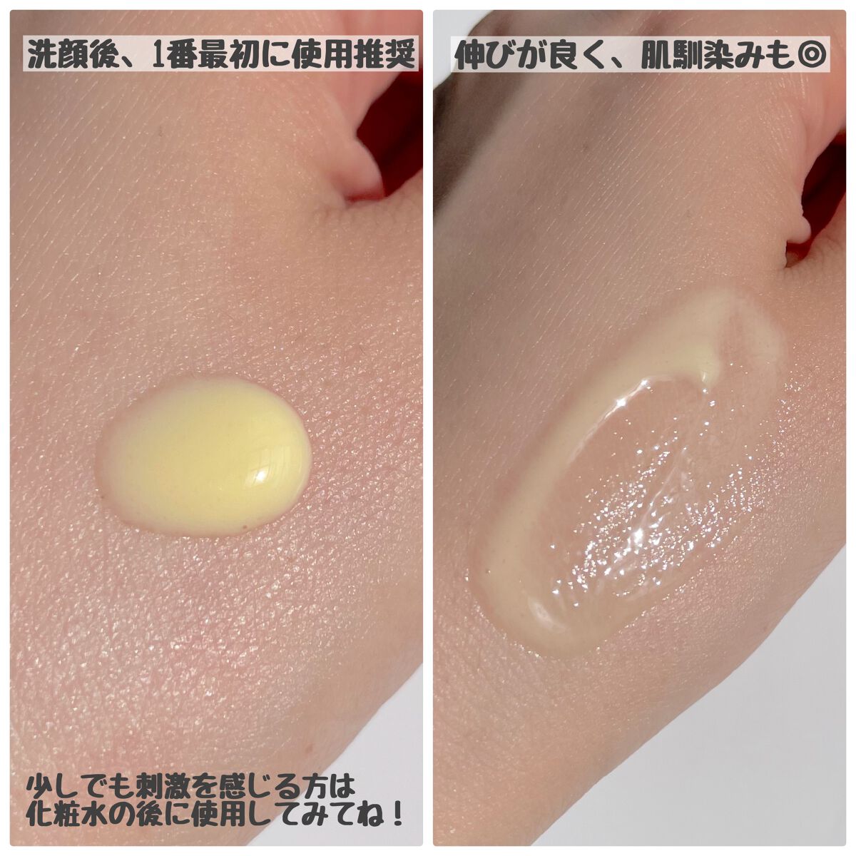 8デイズピュアビタミンCアンプル/VARI:HOPE/美容液を使ったクチコミ(5枚目)