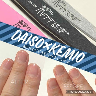 DAISO 激盛れ爪クラブのクチコミ「ネイルNGの学校・職場でも
自爪がちゅるちゅるなのはOK🙆🏻‍♀️？！


Twitterやイ.....」（1枚目）