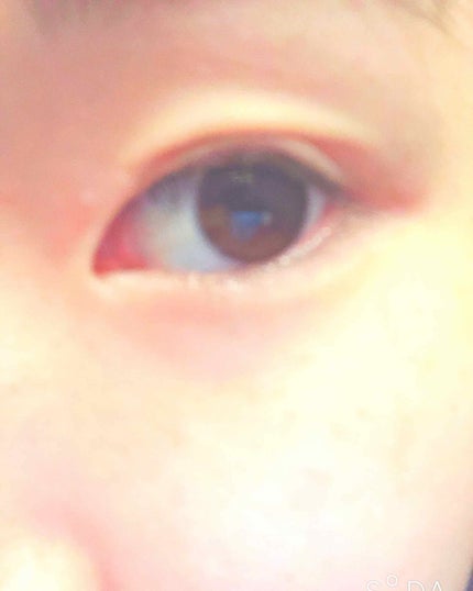 絆創膏/DAISO/その他を使ったクチコミ(2枚目)