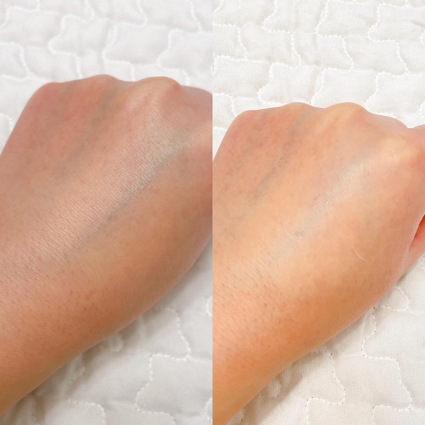 エイクリアリングアクティブパンテノール3％フェイシャルセラム/MEDITHERAPY/美容液を使ったクチコミ（2枚目）