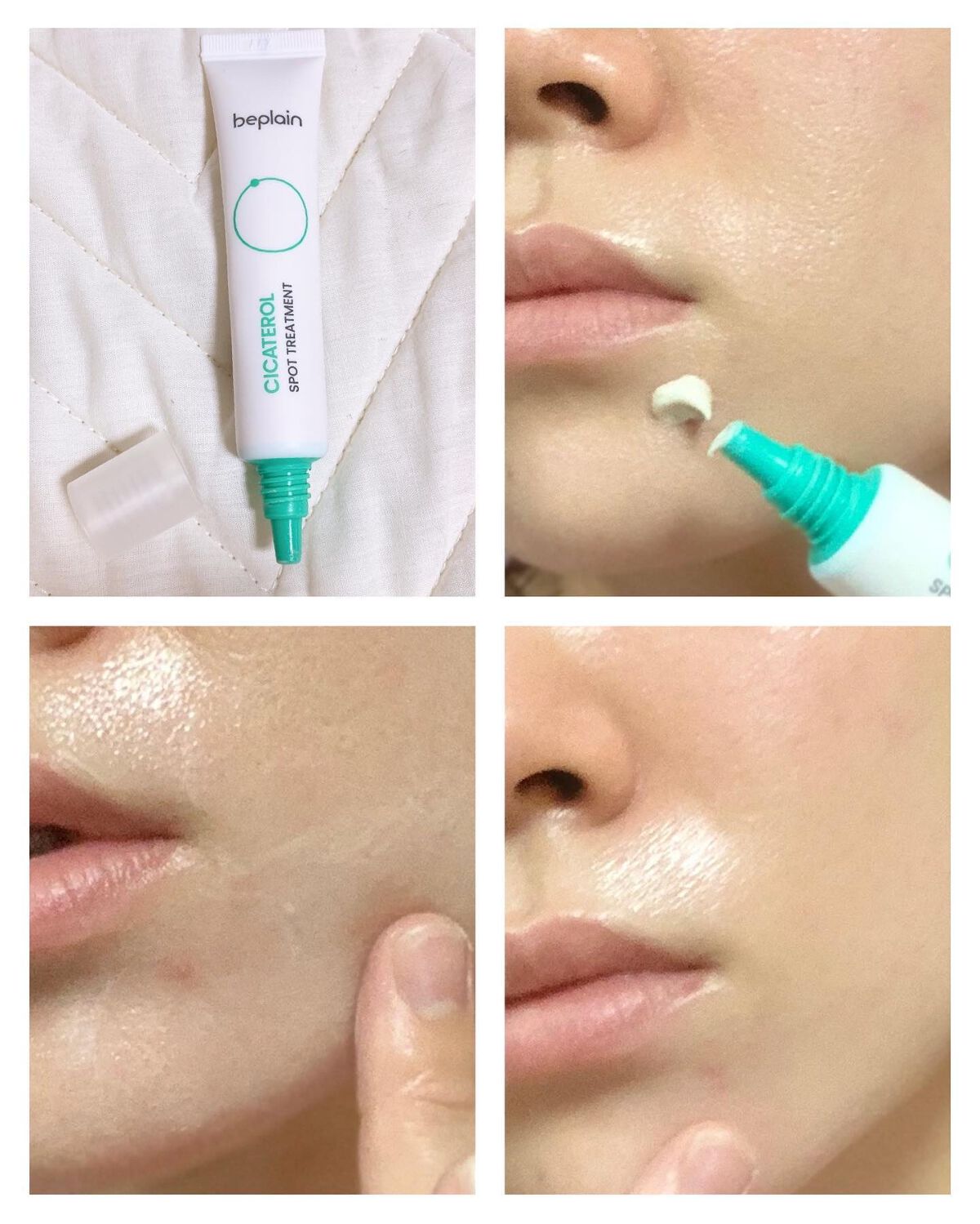 シカテロル美容液/beplain/美容液を使ったクチコミ(7枚目)