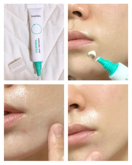 シカテロル美容液/beplain/美容液を使ったクチコミ(7枚目)