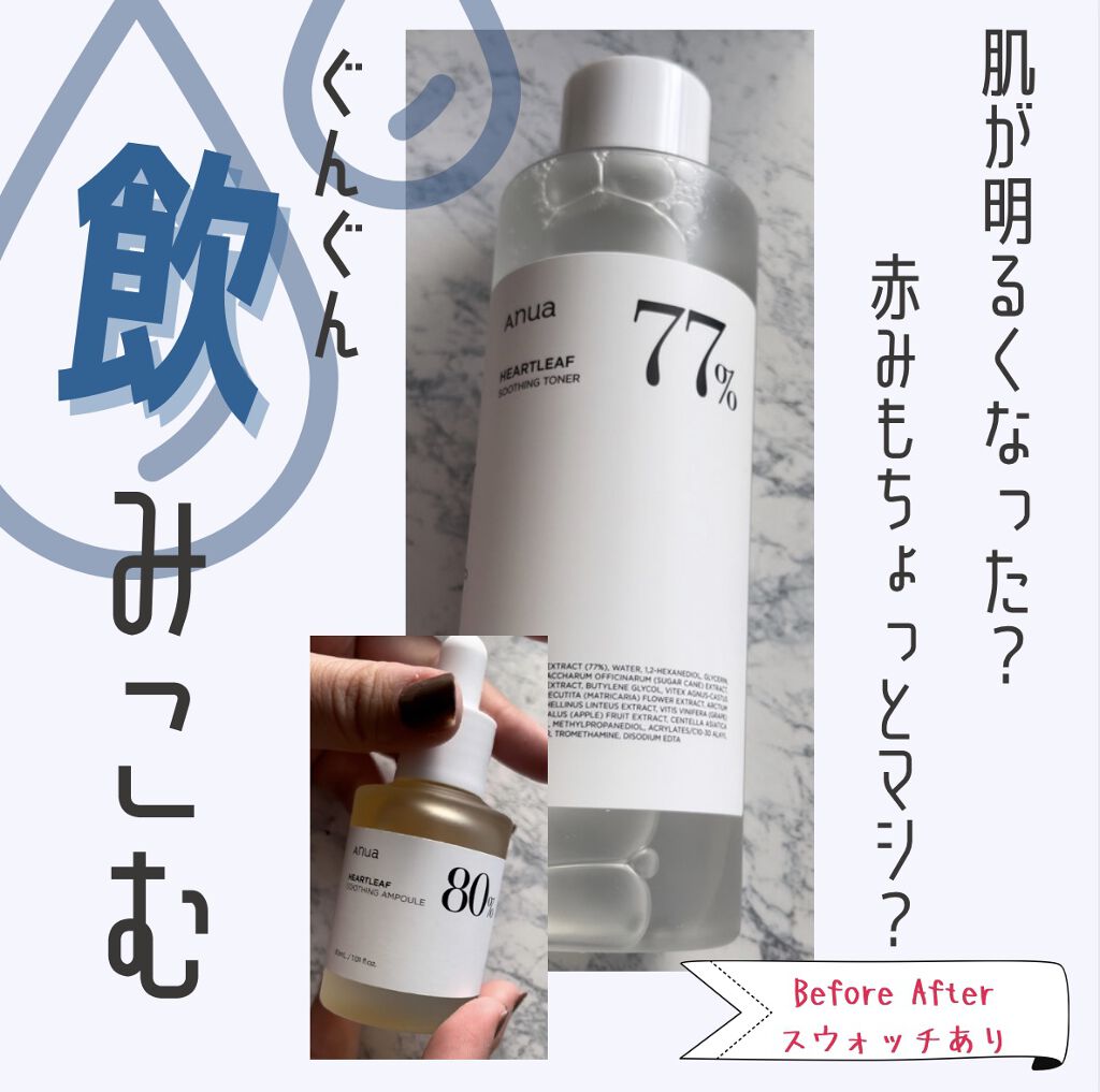 ドクダミ 77 スージングトナー/Anua/化粧水を使ったクチコミ（1枚目）