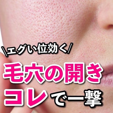 あなたの肌に合ったスキンケア💐コーくん on LIPS 「【来年までに毛穴の開きをなくしたい人だけ見てください。】.....」（1枚目）