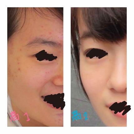 明色美顔水 薬用化粧水/美顔/化粧水を使ったクチコミ(2枚目)