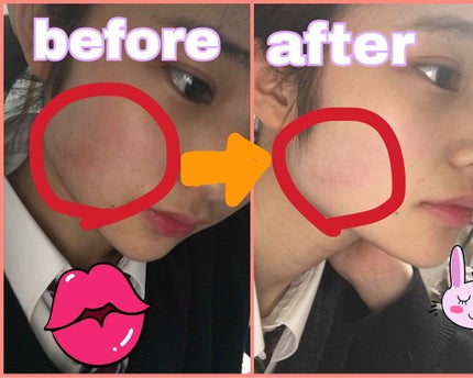 赤み補正コンシーラー/CEZANNE/クリームコンシーラーを使ったクチコミ(3枚目)