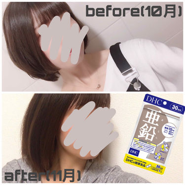 ヘアケア方法 亜鉛 30日分 栄養機能食品 亜鉛 Dhcの使い方 効果 1ヶ月で2 3cm By Nil 混合肌 代後半 Lips