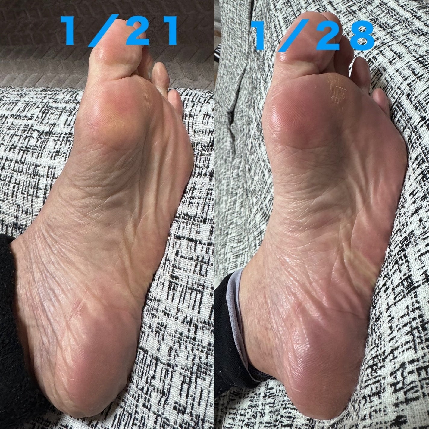 ネイチャーコンク薬用フットケアローション/ネイチャーコンク/レッグ・フットケアを使ったクチコミ(4枚目)