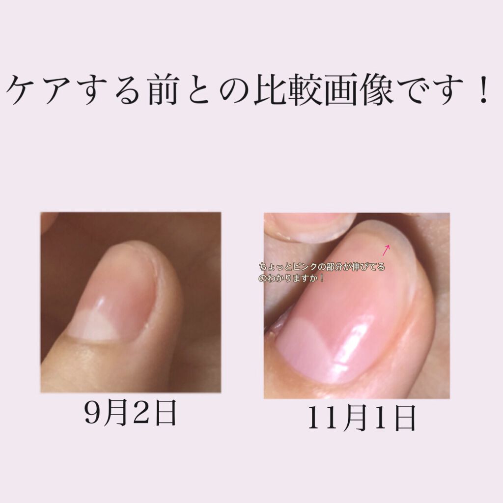 ネイルケアオイル/無印良品/ネイルオイル・トリートメントを使ったクチコミ（2枚目）