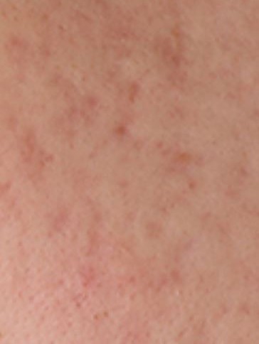 イハダ 薬用バーム【医薬部外品】/IHADA/フェイスバームを使ったクチコミ（1枚目）