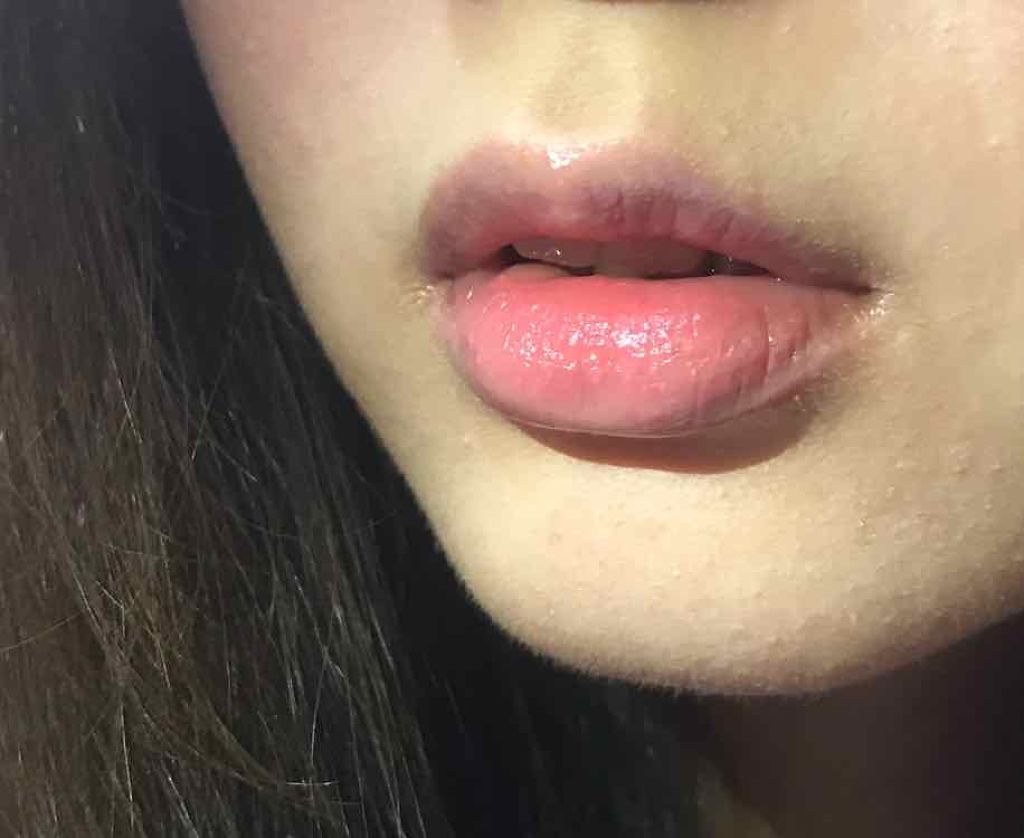 リップフォンデュ/メンソレータム/リップバームを使ったクチコミ（1枚目）