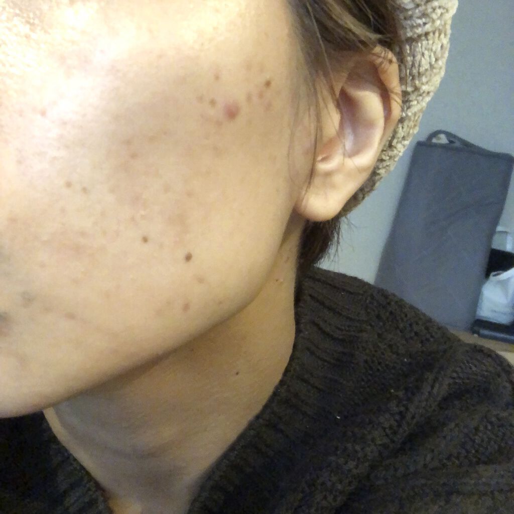 弱酸性pHシートマスク ドクダミフィット/Abib /シートマスク・パックを使ったクチコミ（2枚目）