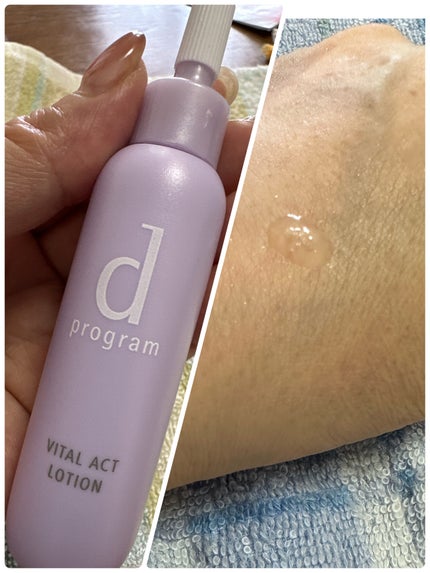 バイタルアクト ローション MB/d プログラム/化粧水を使ったクチコミ(2枚目)
