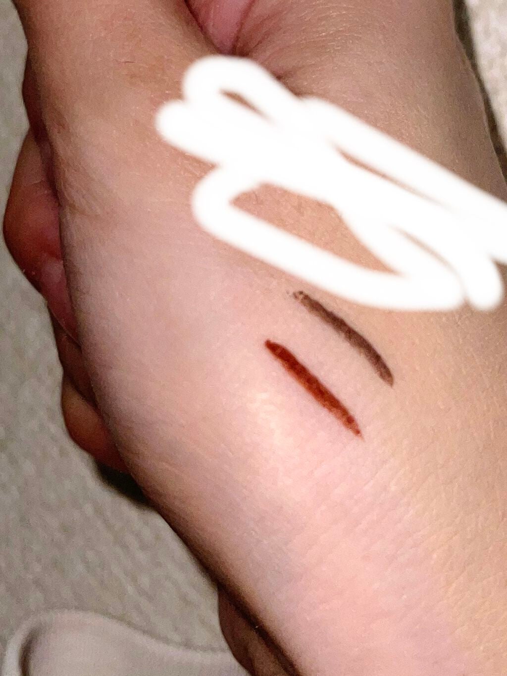 ã·ã«ããŒãªãããã¢ã€ã©ã€ããŒWP/D-UP/ãªãããã¢ã€ã©ã€ããŒã䜿ã£ãã¯ãã³ãïŒ2æç®ïŒ