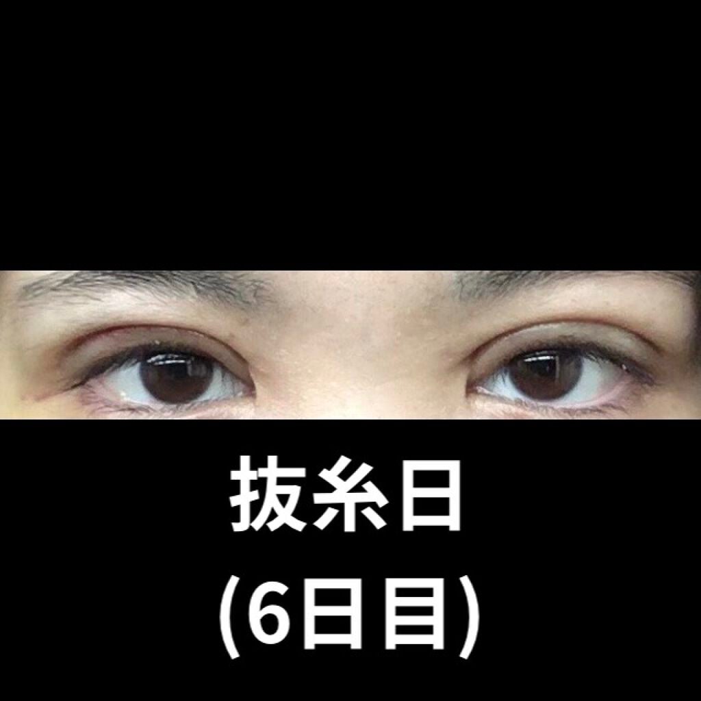 スカルプD ボーテ ピュアフリーアイラッシュセラム プレミアム/アンファー(スカルプD)/まつげ美容液を使ったクチコミ(8枚目)