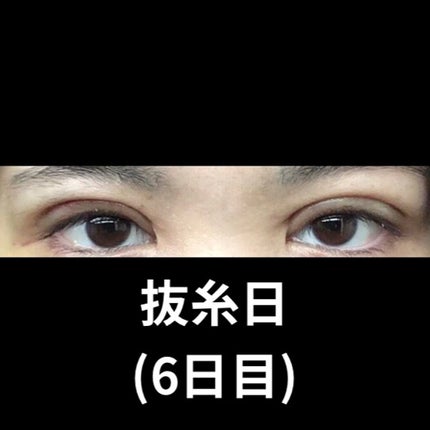 スカルプD ボーテ ピュアフリーアイラッシュセラム プレミアム/アンファー(スカルプD)/まつげ美容液を使ったクチコミ(8枚目)