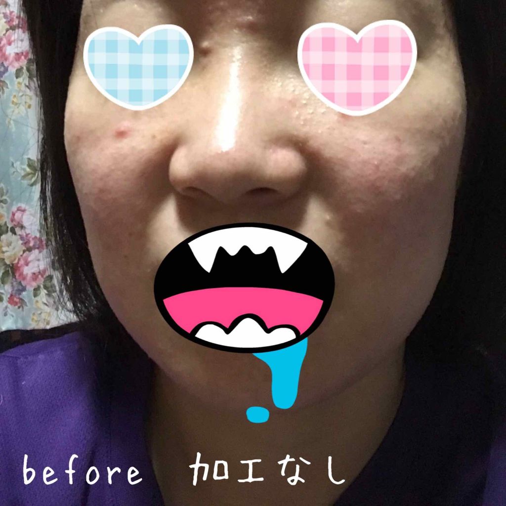 薬用パウダー化粧水/メンソレータム アクネス/化粧水を使ったクチコミ(3枚目)