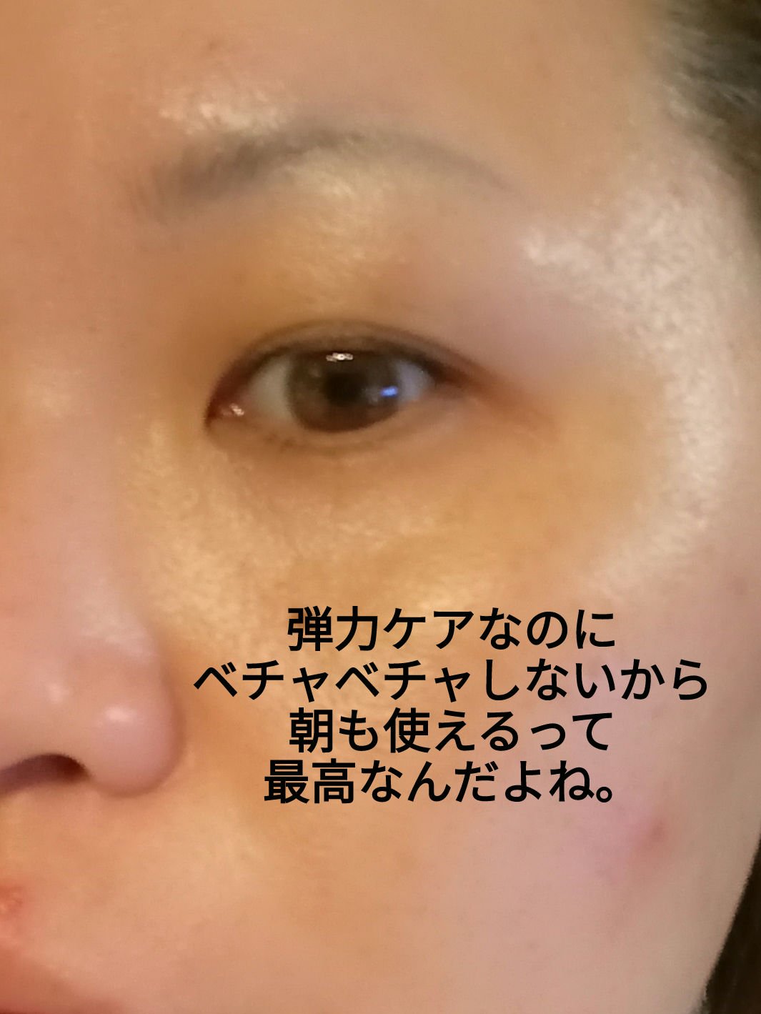 リードルショット リフティングセラム/VT/美容液を使ったクチコミ（3枚目）