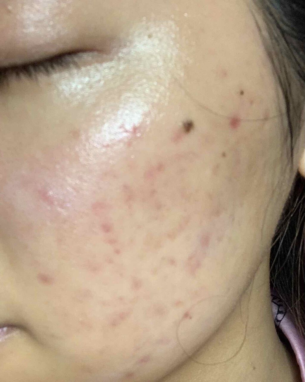 クリアウォッシュ/オルビス/洗顔フォームを使ったクチコミ（1枚目）