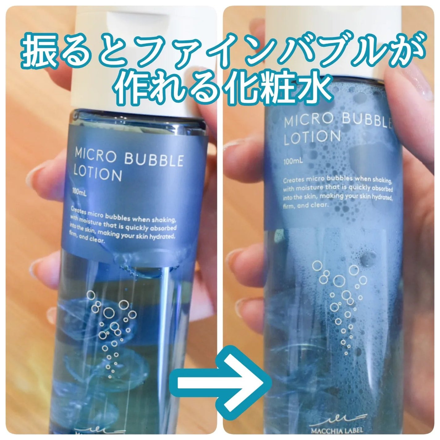 薬用マイクロバブルローション/Macchia Label/化粧水を使ったクチコミ(1枚目)