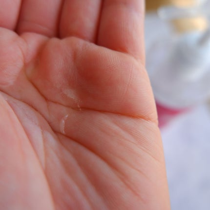 ヘパトリート 薬用保湿化粧水/ゼトックスタイル/化粧水を使ったクチコミ(2枚目)